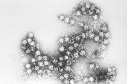 Enterovirus reported in Oklahoma; precaution urged