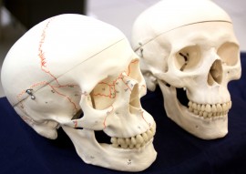 The newly donated anatomical skulls, such as the one on the left, have darker suture lines than the Biology Lab's older skulls (right) said Health Professions Club President Caleb Hill. Melissa Sue Lopez/Pioneer.